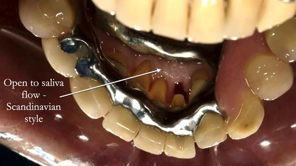 Ken – going downhill, first class