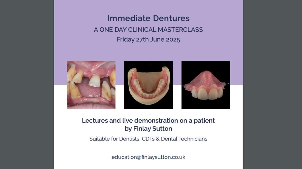 Newsletter 76: Jackie’s case – Telescopic overdenture & precision RPD (the tricky truth!)