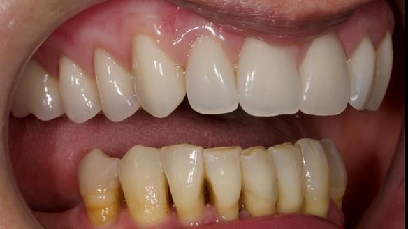 Newsletter 79 – Creating a wonderful smile and changing a life.