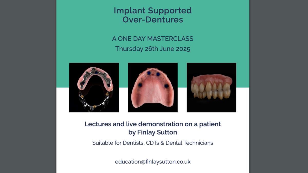 Newsletter 76: Jackie’s case – Telescopic overdenture & precision RPD (the tricky truth!)