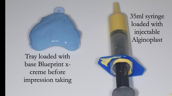 Newsletter 57 showcases the making and fitting process of implant-supported complete dentures for Alisdair